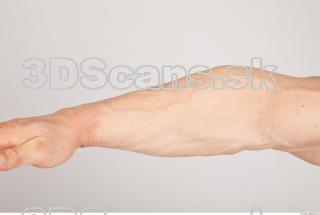 Forearm texture of Gene 0001